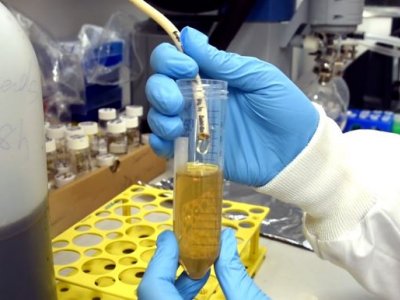 hands in blue gloves hold a small vial containing yellow liquid and white hose